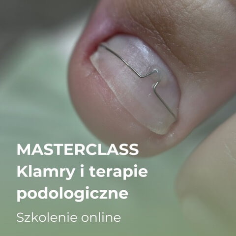 Masterclass: Klamry i terapie podologiczne